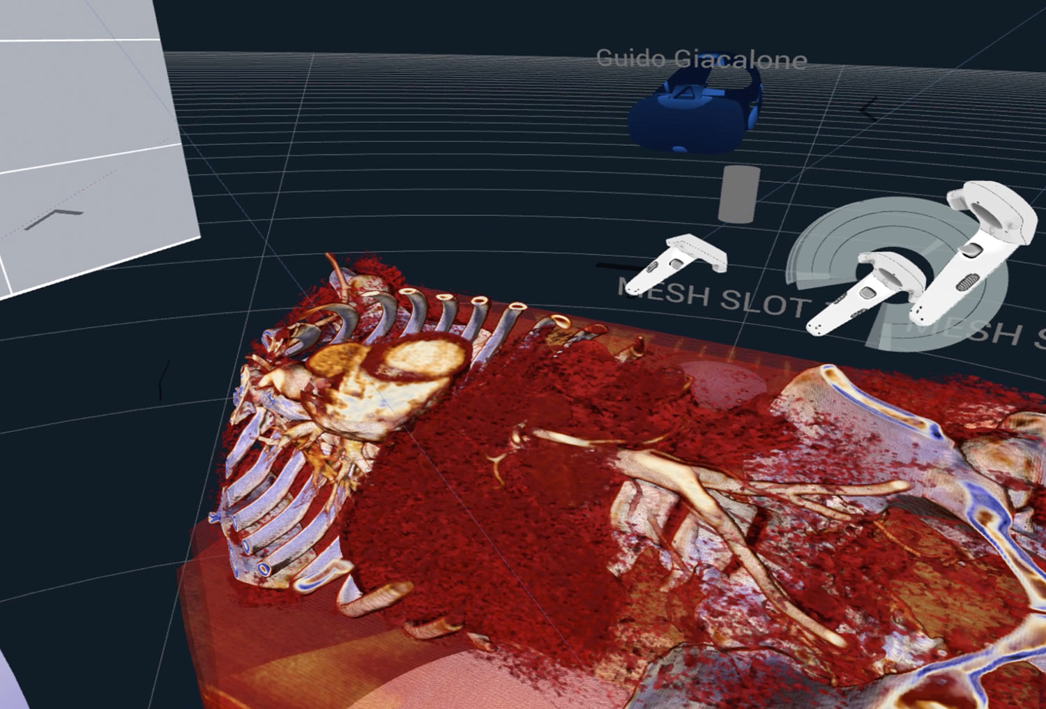 The <strong>DICOM viewer</strong> and <strong>Human Anatomy viewer</strong> for Virtual Reality VR: the first software which enables medical professionals to collaborate in realtime on 3D human anatomy DICOM files