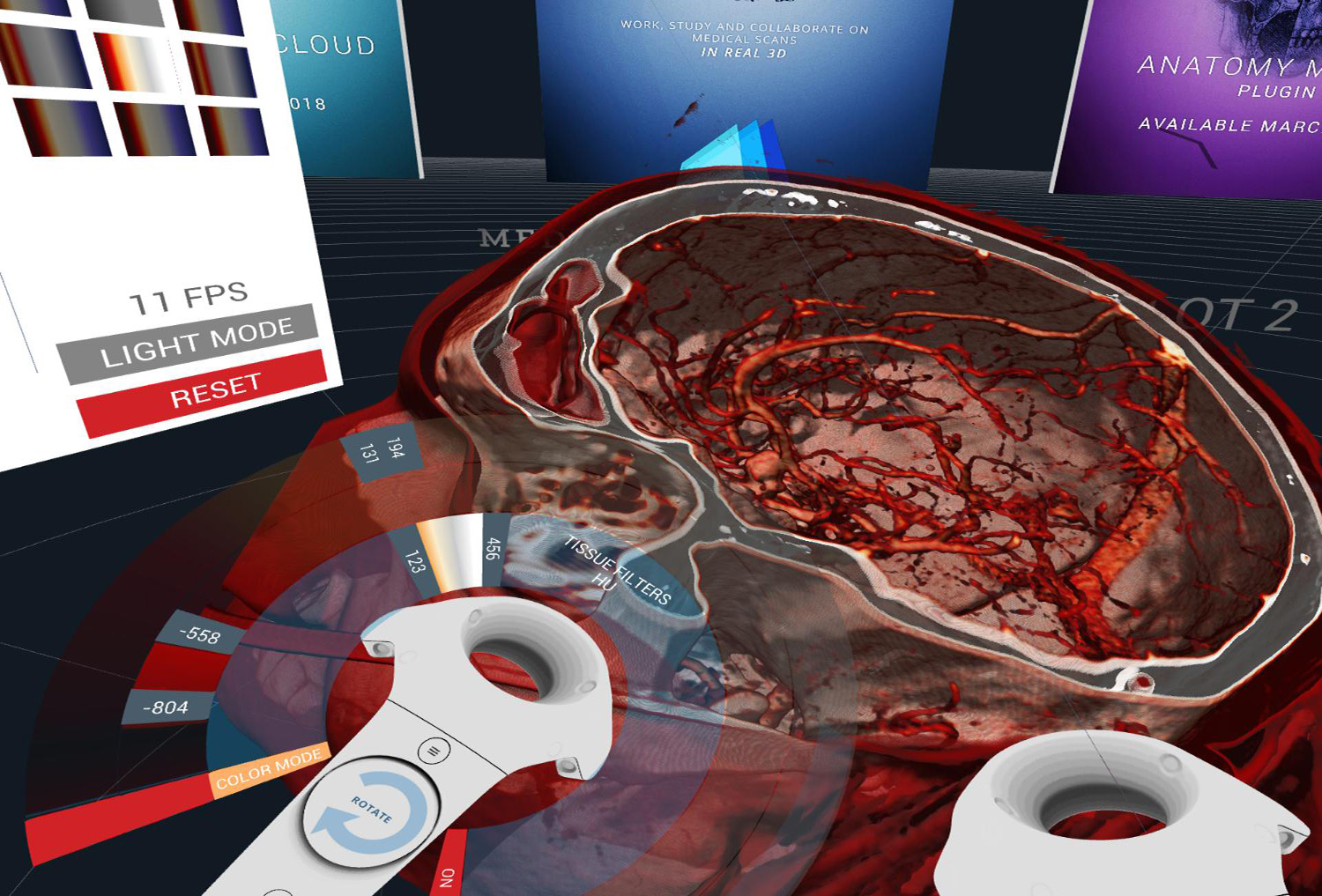 The <strong>DICOM viewer</strong> and <strong>Human Anatomy viewer</strong> for VR Virtual Reality : filter and window human anatomy DICOM files in realtime and 3D