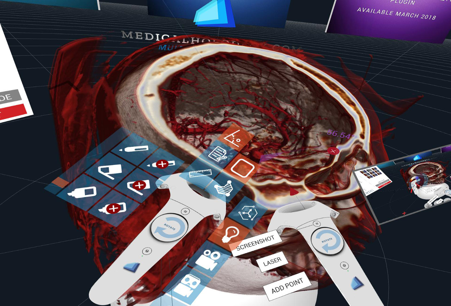 The Medical and Human Anatomy DICOM viewer for Virtual Reality VR</strong>: measure distances, angles, and circumferences in real 3D Virtual Space, directly in the DICOM file. Save, export and share the DICOM file including your work. Experience and view DICOM files in new ways