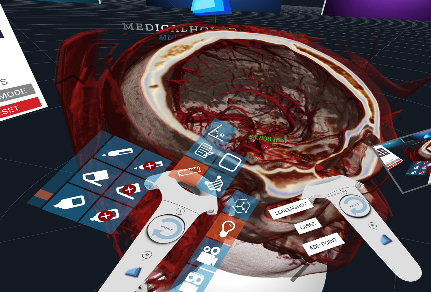 The Medical and Human Anatomy DICOM viewer for Virtual Reality VR</strong>: easy, very fast and precise measuring of distances on DICOM files in real 3D space. View DICOM files, export and share your DICOM data and OBJ data and work with other users online in the cloud