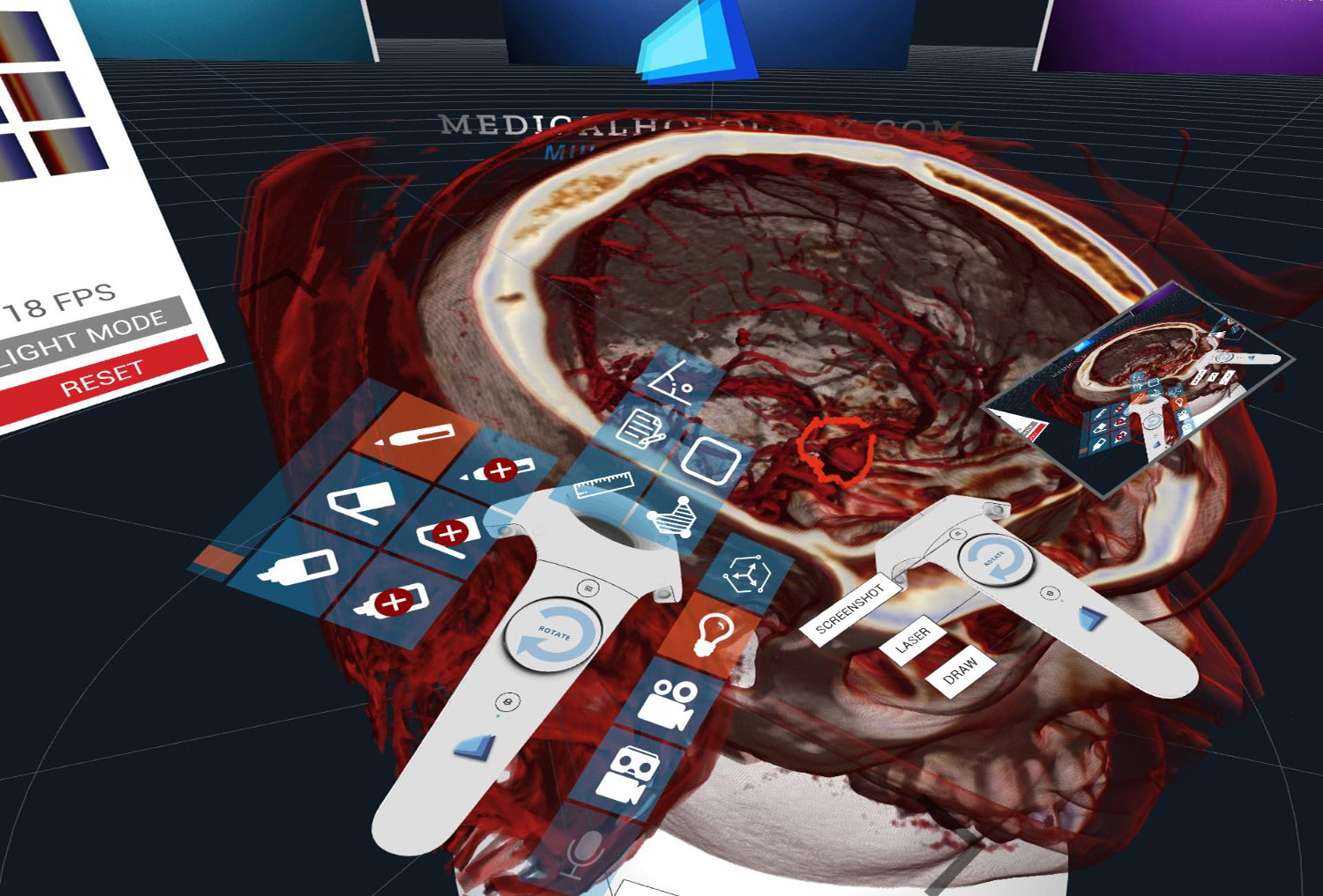 The Medical and Human Anatomy DICOM viewer for Virtual Reality VR</strong>: mark and highlight areas in the 3D DICOM file in 3D virtual space, save, share and export your DICOM file including your work