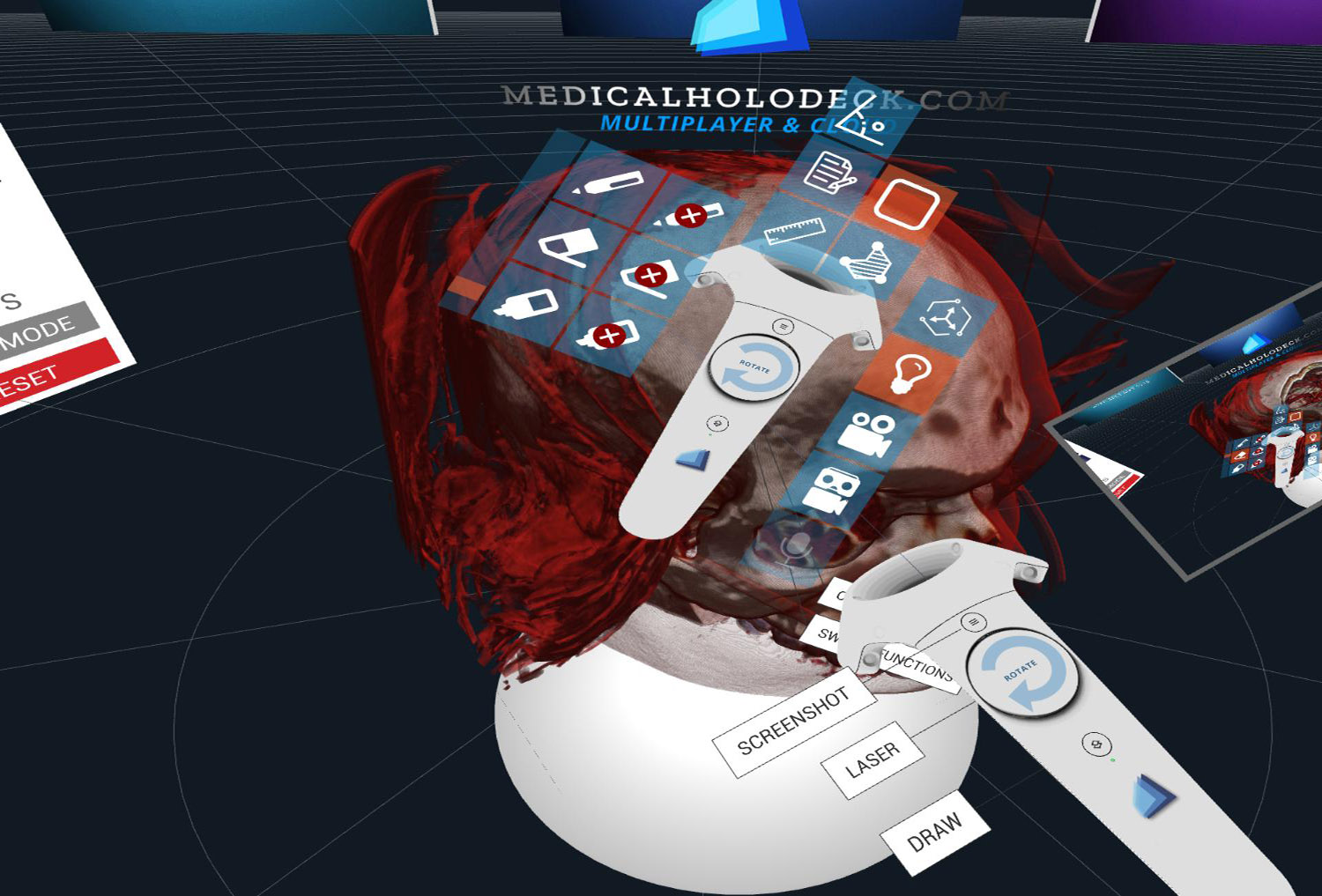 The Medical and Human Anatomy DICOM viewer for Virtual Reality VR</strong>: load DICOM files and create 3D stereoscopic videos which you can play on any smartphone or on Youtube. Use this powerful Virtual Reality feature for easy teaching and sharing within Human Anatomy classes, radiology students or large groups of medical students
