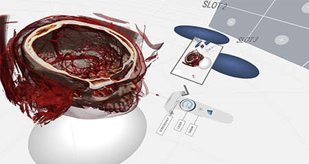 dicom viewer human anatomy controller 1